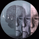 alzheimer.gif