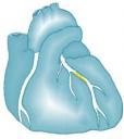 cuore.jpg