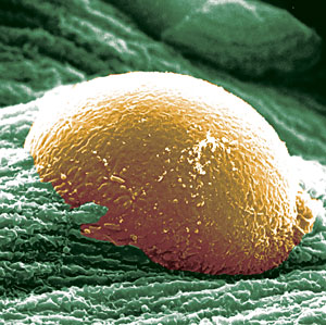 bacteria