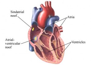 corazon